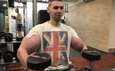 «Синтоловый качок» Терешин вставил импланты в ноги