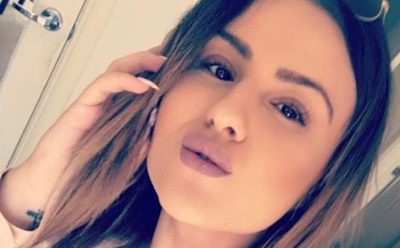 Австралийка после похудения удалила 6 кг кожи