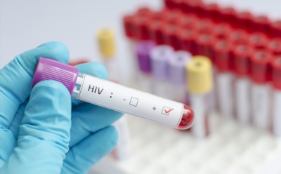 Новая вакцина от ВИЧ сработала на людях