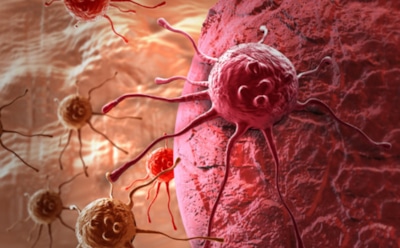 В США медики научились бороться с последней стадией рака