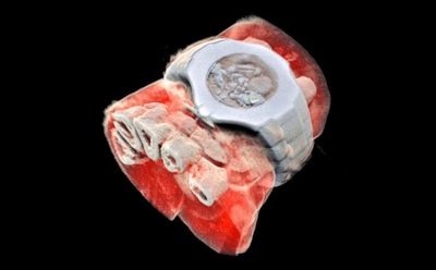 Создан первый в мире цветной 3D-рентген