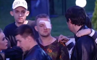 Звезда «Дома-2» Маслов ослеп на один глаз после драки с Романом Гриценко