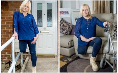 Британка из-за пореза при бритье лишилась ноги