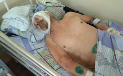 СМИ: в Подмосковье сиделка отправила в кому 84-летнего подопечного