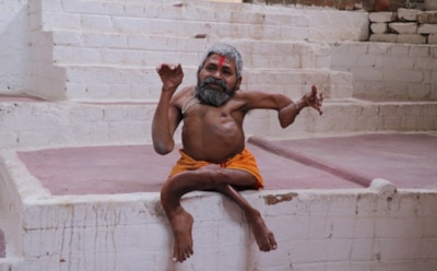 В Индии из-за «мистической» болезни кости мужчины сплетаются между собой