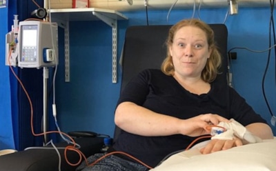 У 35-летней британки обнаружили необычный симптом лимфомы