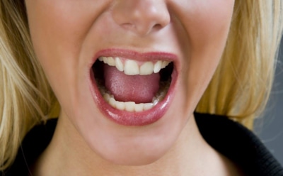 Врачи установили причину появления у американки «черных волос» на языке