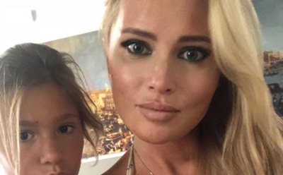 Дана Борисова похвасталась результатами очередной пластики