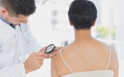 Ученые нашли новый метод борьбы против неоперабельной меланомы