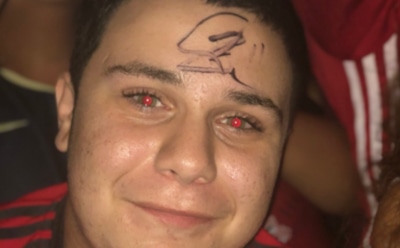 Ибрагимович расписался у фаната на лице после «акробатического» гола