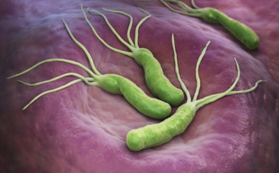 Ученые: инфекция, вызванная бактерией H. pylori, провоцирует рак