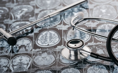 В черепе китайца обнаружили пятисантиметровый гвоздь