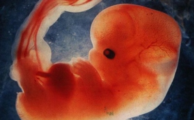 Ученые обнаружили ген, отвечающий за выкидыш во время беременности