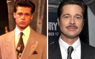 7 звезд, которые сделали пластику ушей