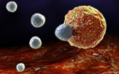 Медики: агрессивные виды рака лучше поддаются лечению