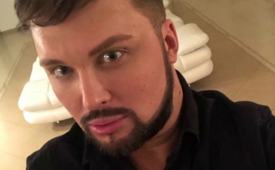 У звезды «Дома-2» Егора Халявина онемела половина лица