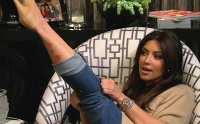 6 звезд с псориазом