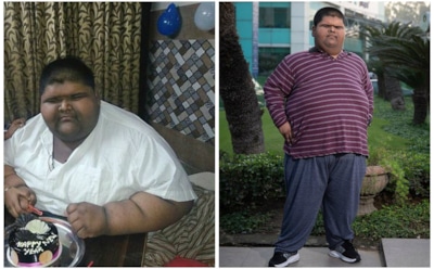 В Индии 14-летний подросток похудел на 100 кг