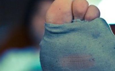 В Китае мужчина попал в больницу, понюхав собственные носки