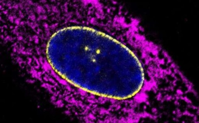 Учеными найден новый способ определить биологический возраст