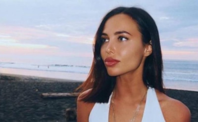 Анастасия Решетова уменьшила губы