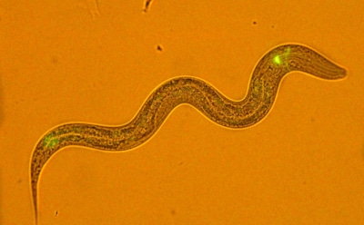 Ученые нашли у червей «молекулу старения»