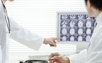 Ученые: найден способ вернуть память при болезни Альцгеймера