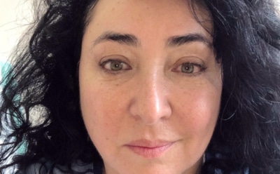 СМИ: Лолита была госпитализирована после концерта в Ростове-на-Дону