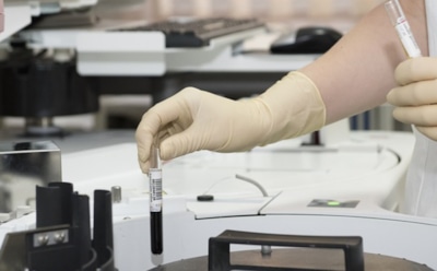 Ученые: паразиты могут превращать человеческие клетки в рак