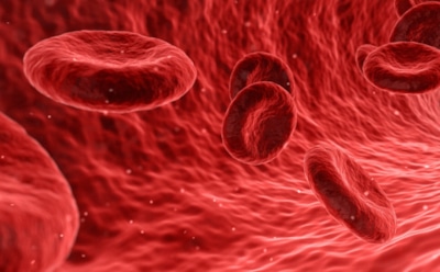 Медики рассказали об основных причинах отрыва тромба