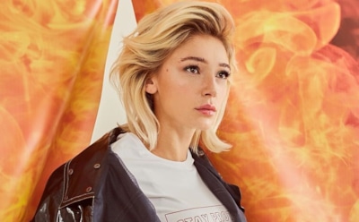 Настя Ивлеева показала фото травмированной руки