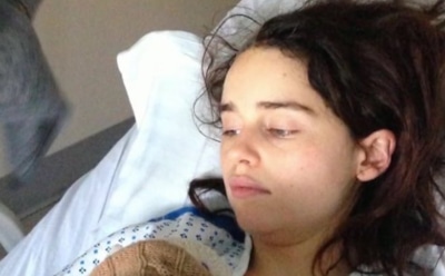 Эмилия Кларк показала фото после трепанации черепа