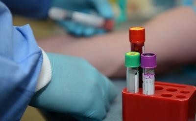 Пациенты рассказали об ощущениях во время клинической смерти