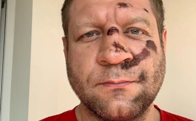 Александр Емельяненко разбился на велосипеде и пересел на велотренажер