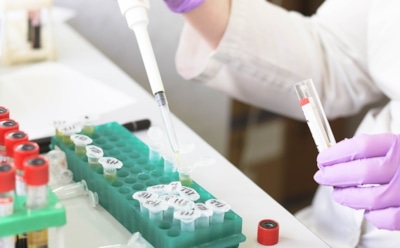 В России назвали регионы с наибольшей распространенностью рака