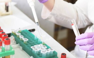 Ученые рассказали о ранних признаках развития болезни Альцгеймера