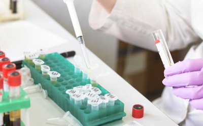 Ученые впервые удалили следы ВИЧ из ДНК мышей