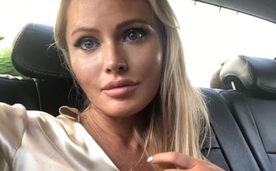 Дана Борисова ужаснула поклонников состоянием своей кожи