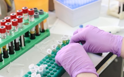 Врачи: окружность талии менее 80 см снижает риск инфаркта у женщин