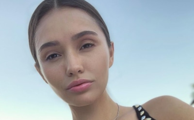 В Сети появилось фото жены Мота до пластики