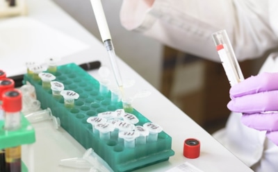 Медики назвали убивающий молодежь вид рака