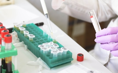 Ученые: проблемы с отцовством повышают риск рака простаты