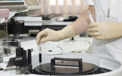 Донор спермы из США подал в суд на клинику, узнав, что стал отцом 17 детей