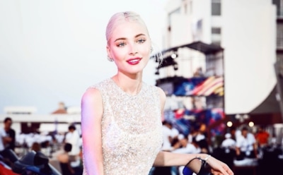 Алена Шишкова призналась, что в детстве потеряла голос