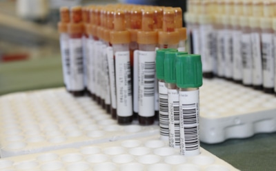 В Ставропольском крае 5 пациентов больницы случайно заразили ВИЧ