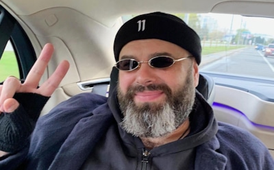 Фадеев показал фото Глюкозы с обгоревшим лицом