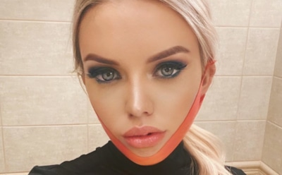 Тюльпанова перестала узнавать знакомых из-за проблем с глазами