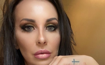 Анна Грачевская показала «новый» нос и подбородок после пластики