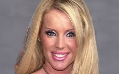 Голливудскую актрису Хезер Паркхерст искусали бойцовые собаки