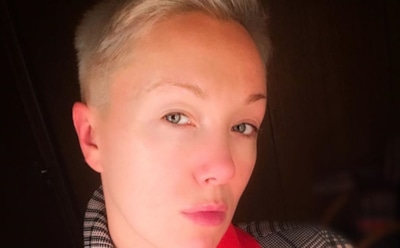 Дарья Мороз ответила на обвинения в пластических операциях